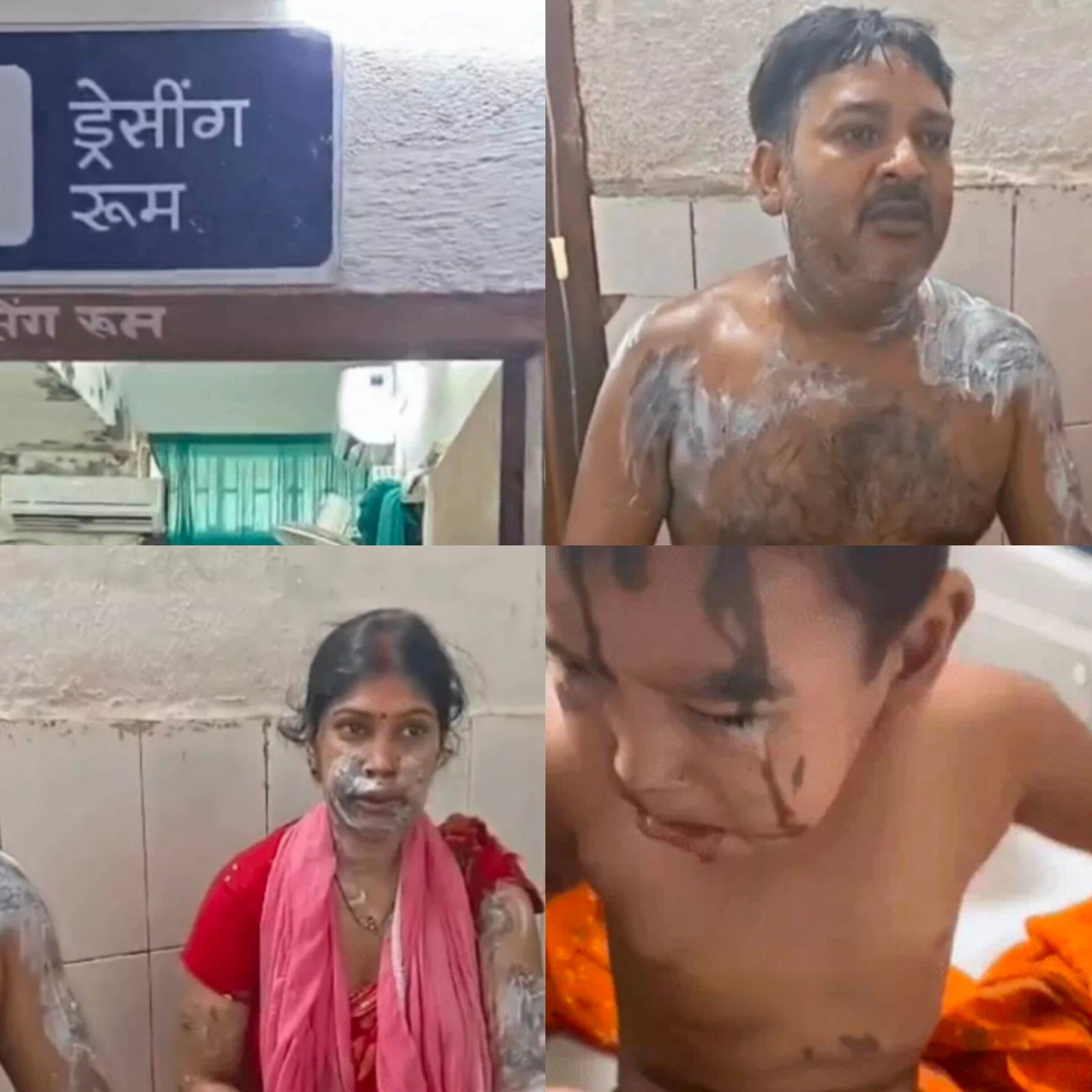 केसरिया में तेजाब कांड: पैसों के विवाद की आग में झुलसा स्वर्ण व्यवसायी का परिवार